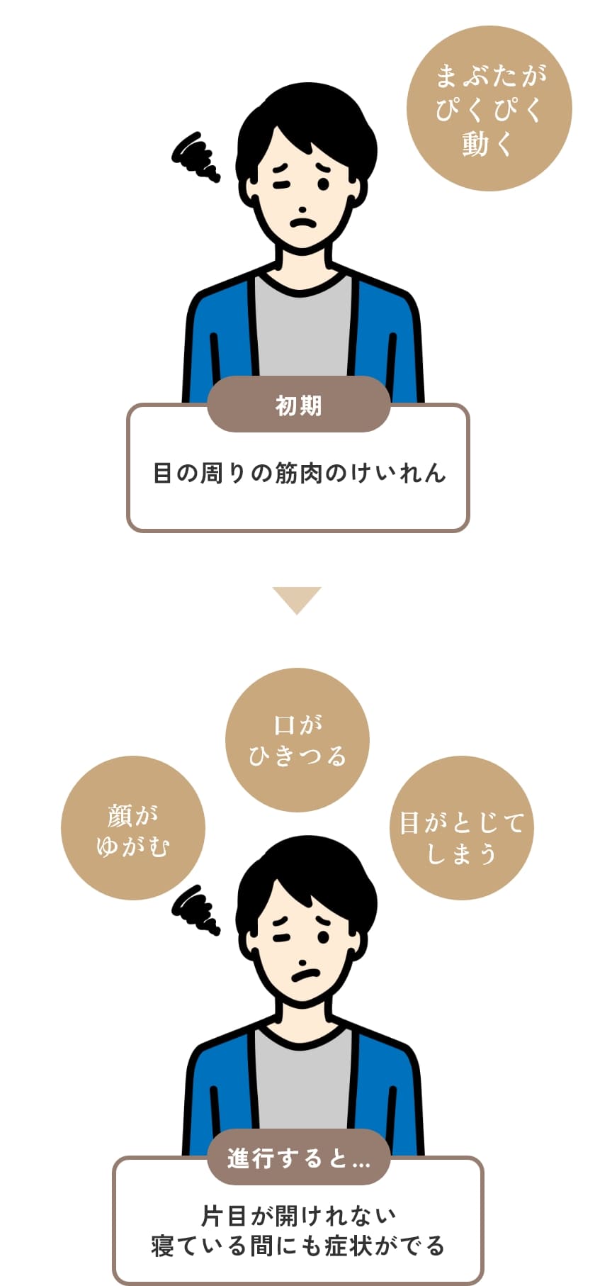 初期…目の周りの筋肉のけいれん 進行すると…片目が開けれない、寝ている間にも症状がでる