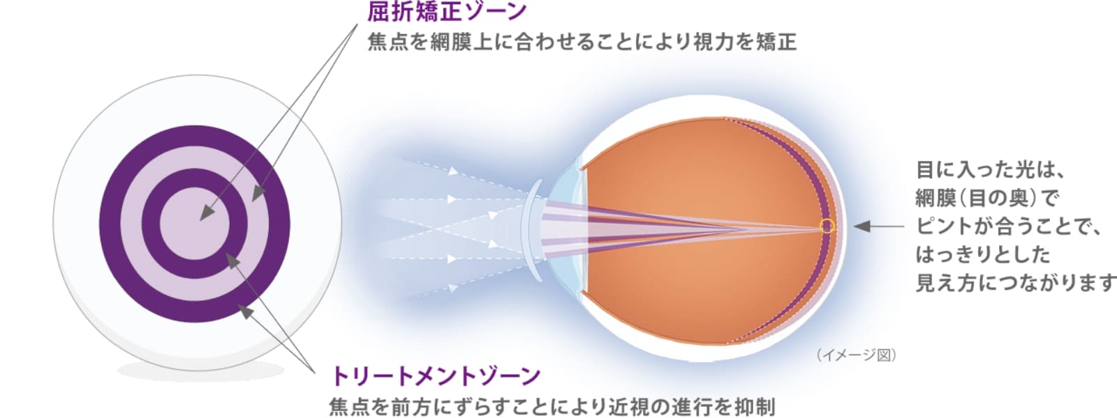 マイサイト ワンデーの構造