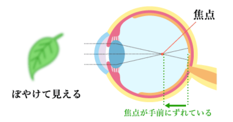 ぼやけて見える