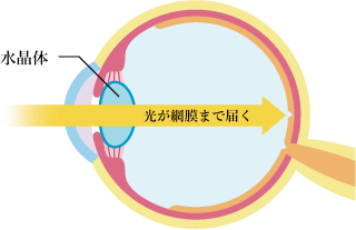 正常な水晶体に光が通る眼球断面図